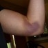 bicep3 bicep3